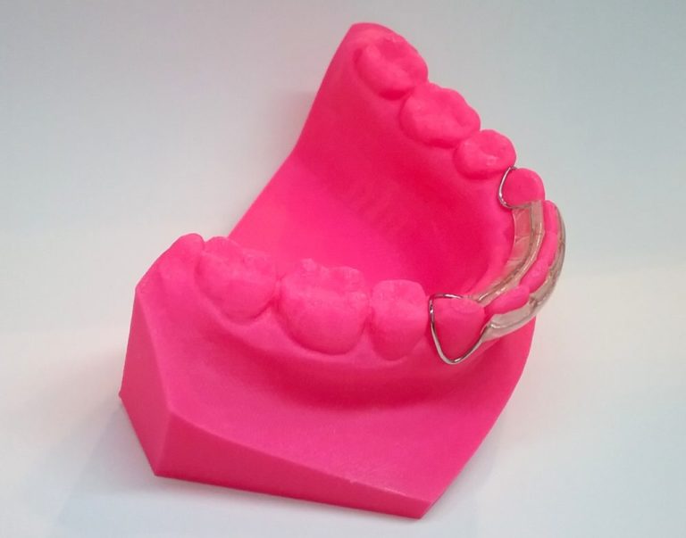 Spring Retainer laboratoirelepicq.fr