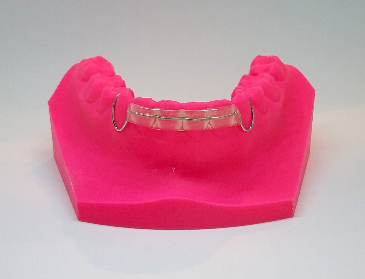Spring Retainer laboratoirelepicq.fr
